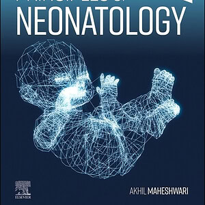 Principles of Neonatology - eBook