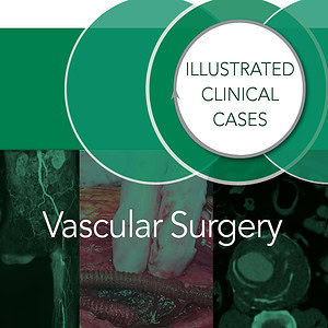 Vascular Surgery: Illustrated Clinical Cases - eBook