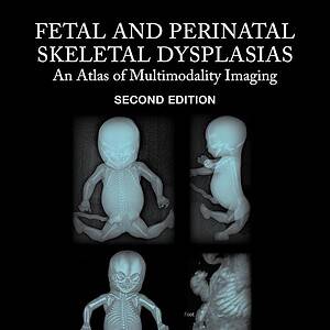 Fetal and Perinatal Skeletal Dysplasias An Atlas of Multimodality Imaging (2nd Edition) - eBook