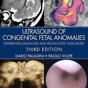Ultrasound of Congenital Fetal Anomalies Differential Diagnosis and Prognostic Indicators (3rd Edition) - eBook