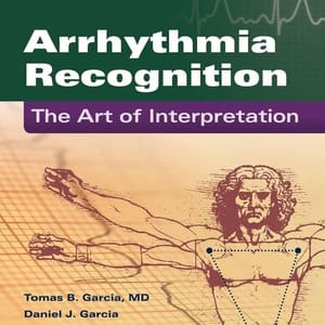 Arrhythmia Recognition: The Art of Interpretation (2nd Edition) - eBook