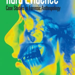 Hard Evidence: Case Studies in Forensic Anthropology (2nd Edition) - eBook